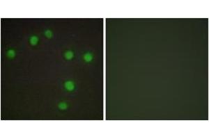 Immunofluorescence analysis of HuvEc cells, using NKX6. (NK6 Homeobox 3 Antikörper  (AA 161-210))