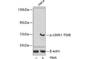 Western blot analysis of extracts from HeLa cells, using Phospho-LIMK1-T508 antibody (ABIN3020309, ABIN3020310, ABIN3020311, ABIN1681739 and ABIN7101871). (LIM Domain Kinase 1 Antikörper  (pThr508))