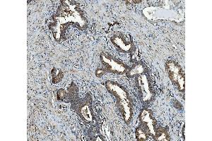 IHC analysis of RAB1B using anti-RAB1B antibody (ABIN7602809). (RAB1B Antikörper  (C-Term))