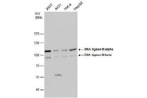 WB Image DNA ligase III antibody detects DNA ligase III protein by western blot analysis. (LIG3 Antikörper)
