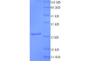 SDS-PAGE (SDS) image for Ciliary Neurotrophic Factor (CNTF) (AA 4-196), (partial) protein (His tag) (ABIN1095544)