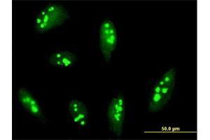 Immunofluorescence of purified MaxPab antibody to RRP12 on HeLa cell.