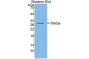 Western Blot; Sample: Recombinant protein. (Fibulin 1 Antikörper  (AA 176-398))