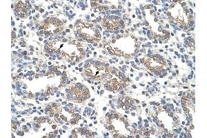 Arginase 1 antibody was used for immunohistochemistry at a concentration of 4-8 ug/ml to stain Alveolar cells (arrows) in Human Lung. (Liver Arginase Antikörper  (Arg1, N-Term))