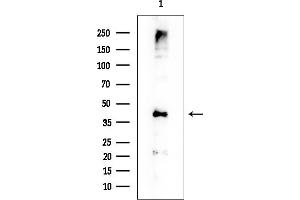 Western blot analysis of lysates from EC304 cells, using B3GALT4 Mouse Monoclonal Antibody at 1/1000 dilution.