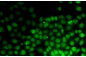 Immunofluorescence analysis of HeLa cells using HMGN2 Polyclonal Antibody (HMGN2 Antikörper)