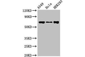 Western Blot Positive WB detected in: A549 whole cell lysate, Hela whole cell lysate, HEK293 whole cell lysate All lanes: CRTC1 antibody at 3. (CRTC1 Antikörper  (AA 1-248))