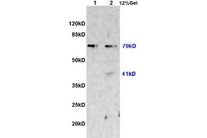 L1 rat heart lysates L2 rat brain lysates probed with Anti CX3CL1 Polyclonal Antibody, Unconjugated (ABIN728488) at 1:200 overnight at 4 °C. (CX3CL1 Antikörper  (AA 301-397))
