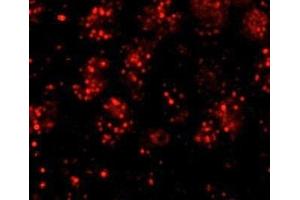 Immunofluorescence (IF) image for anti-PHD Finger Protein 6 (PHF6) (AA 125-175) antibody (ABIN7448999) (PHF6 Antikörper  (AA 125-175))