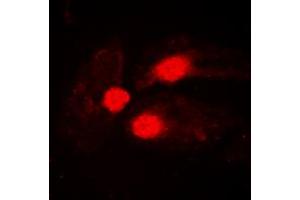 Immunofluorescent analysis of BTK (pY551) staining in Jurkat cells.