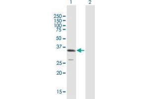Western Blot analysis of ULBP1 expression in transfected 293T cell line by ULBP1 MaxPab polyclonal antibody.