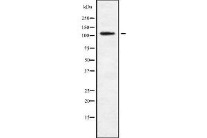 Western blot analysis of MAGE1 using K562 whole cell lysates (MAGEE1 Antikörper  (Internal Region))