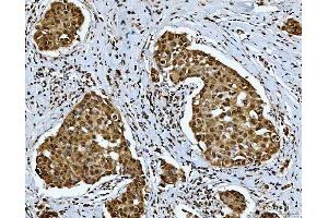 IHC analysis of SNRPN using anti-SNRPN antibody (ABIN3043934). (SNRPN Antikörper  (N-Term))