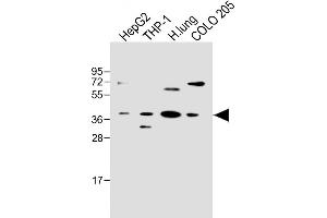 All lanes : Anti-FCGRT Antibody (C-term) at 1:500 dilution Lane 1: HepG2 whole cell lysate Lane 2: THP-1 whole cell lysate Lane 3: Human lung lysate Lane 4: COLO 205 whole cell lysate Lysates/proteins at 20 μg per lane. (FcRn Antikörper  (C-Term))