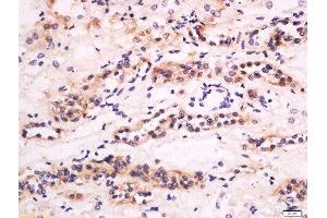 Formalin-fixed and paraffin embedded human kidney labeled with Anti-CXCL14 Polyclonal Antibody, Unconjugated  at 1:200 followed by conjugation to the secondary antibody and DAB staining.