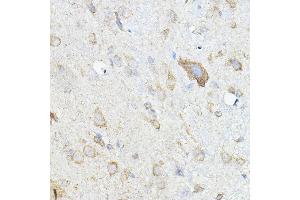 Immunohistochemistry (IHC) image for anti-Hepatocyte Growth Factor (Hepapoietin A, Scatter Factor) (HGF) (AA 30-285) antibody (ABIN3021683)