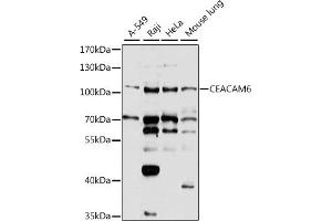 Western blot analysis of extracts of various cell lines, using CE antibody  at 1:1000 dilution. (CEACAM6 Antikörper  (AA 200-320))