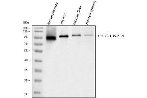 Western blot analysis of PLG using anti-PLG antibody (ABIN6719277).