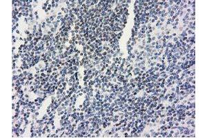 Image no. 1 for anti-Ankyrin Repeat Domain 53 (ANKRD53) (AA 1-300) antibody (ABIN1490718) (ANKRD53 Antikörper  (AA 1-300))
