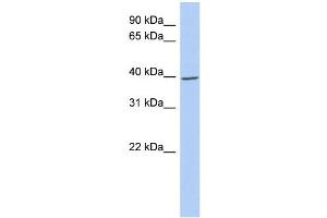 Western Blotting (WB) image for anti-Inhibitor of kappa Light Polypeptide Gene Enhancer in B-Cells, Kinase gamma (IKBKG) (N-Term) antibody (ABIN2779233)