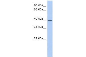 WB Suggested Anti-IKBKG Antibody Titration: 0. (IKBKG Antikörper  (N-Term))
