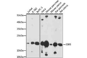 Western blot analysis of extracts of various cells, using SSR3 antibody (ABIN7270298) at 1:1000 dilution. (SSR3 Antikörper  (AA 70-145))