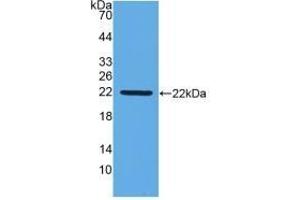 Detection of Recombinant IFNb, Gallus using Monoclonal Antibody to Interferon Beta (IFNb) (IFNB1 Antikörper  (AA 27-203))
