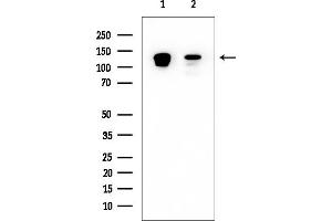 Western blot analysis of lysates from various samples, using p130 Cas Mouse Monoclonal Antibody at 1/1000 dilution.