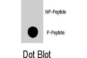 Dot blot analysis of TSC2 (phospho S1420) polyclonal antibody  on nitrocellulose membrane.