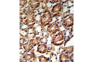 Immunohistochemistry (IHC) image for anti-Guanine Monophosphate Synthetase (GMPS) antibody (ABIN3001740) (GMP Synthase Antikörper)