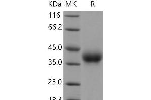 Western Blotting (WB) image for CD84 (CD84) (Active) protein (His tag) (ABIN7320156) (CD84 Protein (CD84) (His tag))