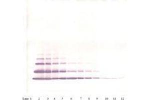 Image no. 2 for anti-Chemokine (C-X-C Motif) Ligand 2 (CXCL2) antibody (ABIN465915) (CXCL2 Antikörper)