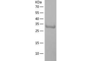 Western Blotting (WB) image for Ankyrin Repeat Domain 1 (Cardiac Muscle) (ANKRD1) (AA 1-319) protein (His tag) (ABIN7121837)