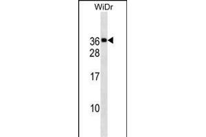 MED30 Antibody (Center) (ABIN1537737 and ABIN2838170) western blot analysis in WiDr cell line lysates (35 μg/lane). (MED30 Antikörper  (AA 107-133))