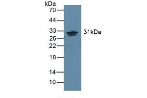 Western blot analysis of recombinant Human CA2. (CA2 Antikörper)
