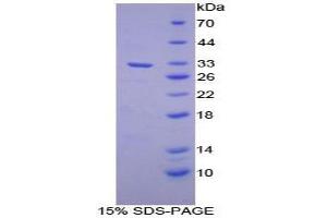 SDS-PAGE analysis of Mouse Alanine Aminopeptidase Protein. (ALT Protein)