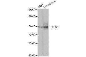Western blot analysis of extracts of various cell lines, using RIPK4 antibody (ABIN5974690) at 1/1000 dilution. (RIPK4 Antikörper)