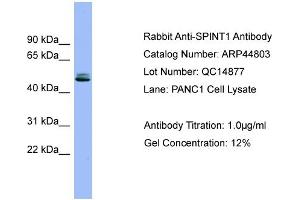 WB Suggested Anti-SPINT1  Antibody Titration: 0. (SPINT1 Antikörper  (Middle Region))