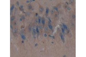 Used in DAB staining on fromalin fixed paraffin- embedded Kidney tissue (IDS Antikörper  (AA 107-363))