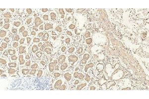 Immunohistochemistry of paraffin-embedded Human stomach tissue using CD4 Monoclonal Antibody at dilution of 1:200. (CD4 Antikörper)