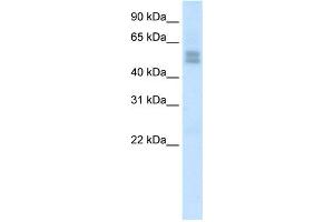 WB Suggested Anti-LMX1B Antibody Titration:  2. (LMX1B Antikörper  (C-Term))