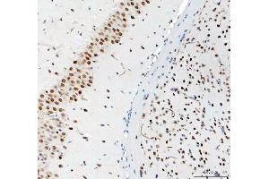 IHC analysis of DDX1 using anti-DDX1 antibody (ABIN7602050).