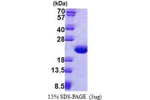 Tubulin Polymerization-Promoting Protein Family Member 3 (TPPP3) (AA 1-176) protein (His tag)