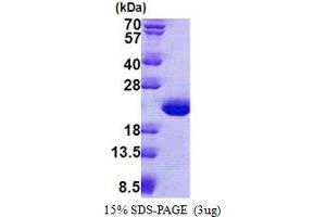 SDS-PAGE (SDS) image for Tubulin Polymerization-Promoting Protein Family Member 3 (TPPP3) (AA 1-176) protein (His tag) (ABIN5853114) (TPPP3 Protein (AA 1-176) (His tag))
