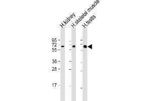 All lanes : Anti-DMRT2 Antibody (Center) at 1:2000 dilution Lane 1: human kidney lysate Lane 2: human skeletal muscle lysate Lane 3: human testis lysate Lysates/proteins at 20 μg per lane. (DMRT2 Antikörper  (AA 357-392))