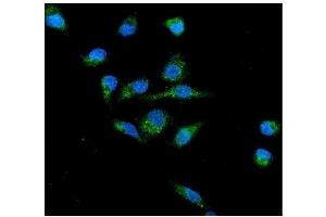anti-Cytochrome B-245, beta Polypeptide (CYBB) (AA 124-559) antibody
