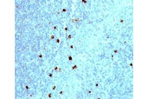 Immunohistochemistry (IHC) image for Mouse anti-Human IgM Heavy Chain antibody (ABIN3026664)