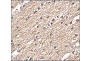 Immunohistochemistry of Spred3 in human brain tissue with this product at 2.
