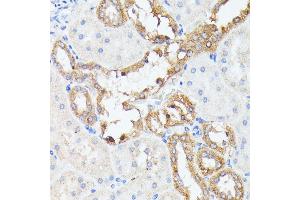 Immunohistochemistry of paraffin-embedded rat kidney using PTP4 antibody (ABIN7269703) at dilution of 1:100 (40x lens). (PTP4A2 Antikörper  (AA 30-100))