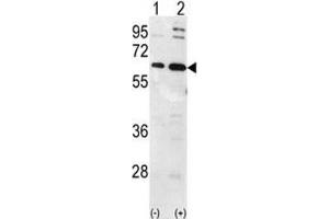 Western blot analysis of Ubiquilin-1 antibody and 293 cell lysate (2 ug/lane) either nontransfected (Lane 1) or transiently transfected with the Ubiquilin1 gene (2).
